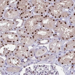 Anti-JDP2 antibody produced in rabbit 