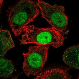 Anti-JMJD6 antibody produced in rabbit 