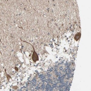 Anti-JMJD7 antibody produced in rabbit 