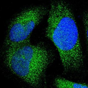 Anti-JMJD7 antibody produced in rabbit 