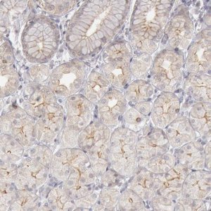 Anti-JOSD1 antibody produced in rabbit 