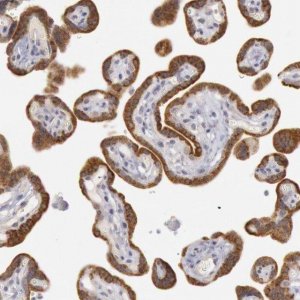 Anti-JOSD1 antibody produced in rabbit 