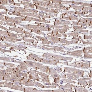 Anti-JPH2 antibody produced in rabbit 