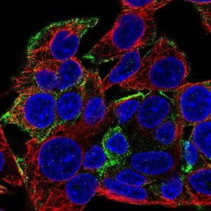 Anti-KANK1 antibody produced in rabbit 