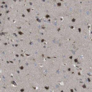Anti-KANK2 antibody produced in rabbit 