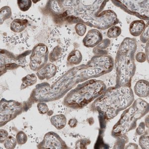 Anti-KANK4 antibody produced in rabbit 