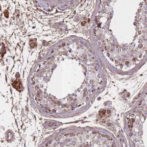 Anti-KAT2A antibody produced in rabbit 