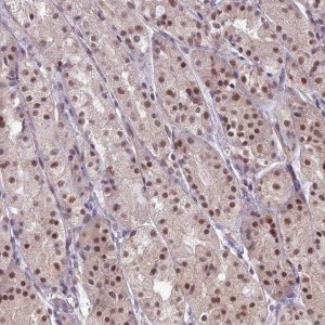 Anti-KAT7 antibody produced in rabbit 