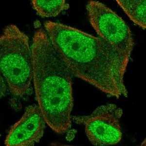 Anti-KAT7 antibody produced in rabbit 