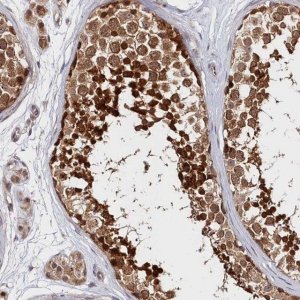 Anti-KATNA1 antibody produced in rabbit 