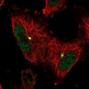 Anti-KATNA1 antibody produced in rabbit 