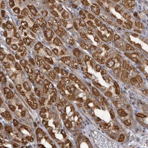 Anti-KBTBD11 antibody produced in rabbit HPA051159-100UL