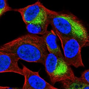 Anti-KBTBD11 antibody produced in rabbit HPA051159-100UL