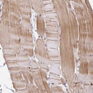 Anti-KBTBD13 antibody produced in rabbit 