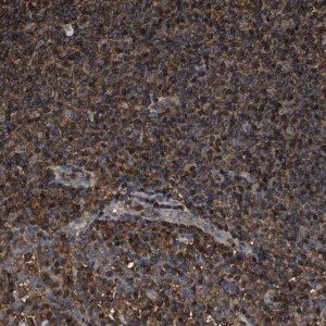 Anti-KBTBD2 antibody produced in rabbit 