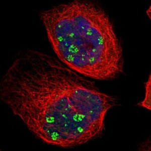 Anti-KBTBD2 antibody produced in rabbit 