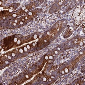 Anti-KBTBD7 antibody produced in rabbit 