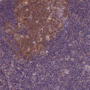 Anti-KBTBD8 antibody produced in rabbit HPA069190-100UL