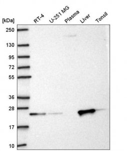 Anti-KBTBD8 antibody produced in rabbit HPA069190-100UL