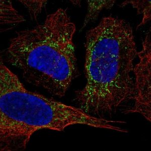 Anti-KCNAB3 antibody produced in rabbit 