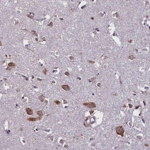 Anti-KCNE5 antibody produced in rabbit 