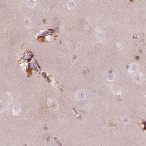 Anti-KCNG2 antibody produced in rabbit 