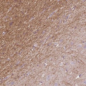 Anti-KCNIP3 antibody produced in rabbit 