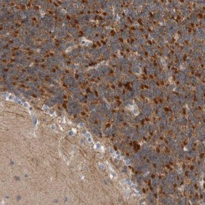 Anti-KCNJ3 antibody produced in rabbit 