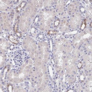 Anti-KCNK5 antibody produced in rabbit 