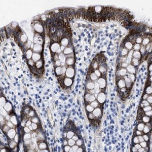Anti-KCNMB3 antibody produced in rabbit 