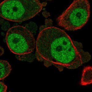 Anti-KCNN3 antibody produced in rabbit 