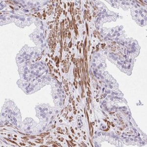 Anti-KCNN4 antibody produced in rabbit 