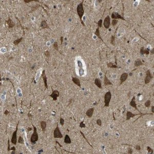 Anti-KCTD10 antibody produced in rabbit 