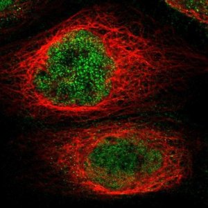 Anti-KCTD10 antibody produced in rabbit 