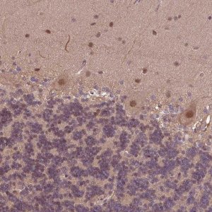 Anti-KCTD11 antibody produced in rabbit 
