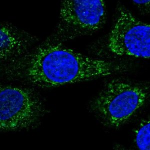 Anti-KCTD18 antibody produced in rabbit 