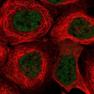 Anti-KCTD9 antibody produced in rabbit 