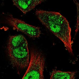 Anti-KDM3B antibody produced in rabbit 