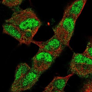 Anti-KDM4B antibody produced in rabbit 