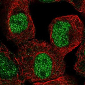 Anti-KDM4C antibody produced in rabbit 