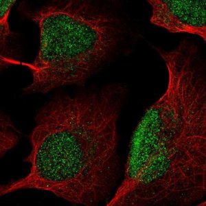 Anti-KDM5B antibody produced in rabbit 