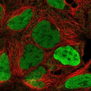 Anti-KDM5C antibody produced in rabbit 