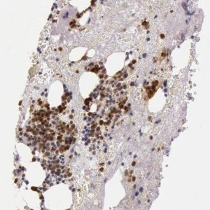 Anti-KDM6A antibody produced in rabbit 