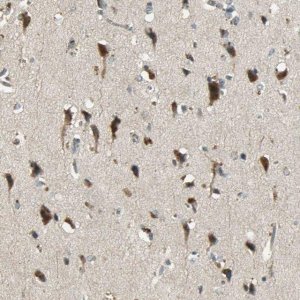 Anti-KEAP1 antibody produced in rabbit 