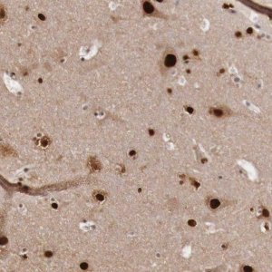 Anti-KHDRBS3 antibody produced in rabbit 