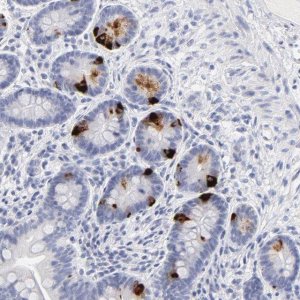 Anti-KHNYN antibody produced in rabbit 