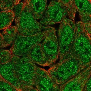 Anti-KHNYN antibody produced in rabbit 