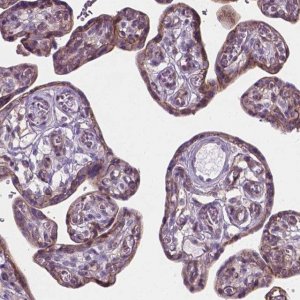 Anti-KIAA0040 antibody produced in rabbit 