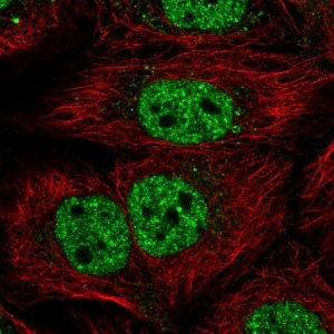 Anti-KIAA0040 antibody produced in rabbit 