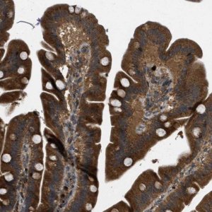 Anti-KIAA0430 antibody produced in rabbit 